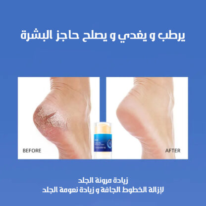 ⁦عرض 2 ستيك مرطب لليدين والقدمين- أزرق⁩ - الصورة ⁦3⁩