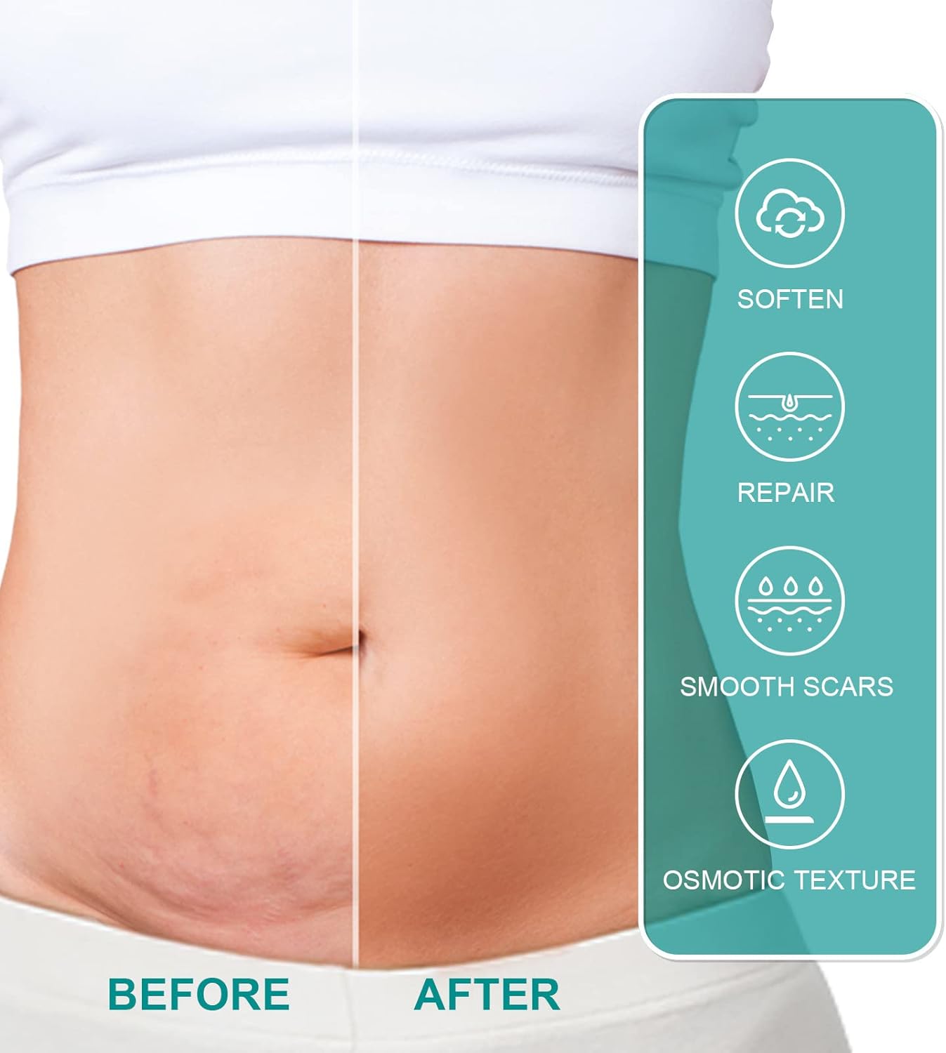 • سبراي طبي لإزالة الندوب - الصورة 6